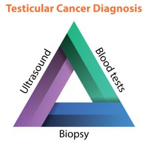 Testicular Cancer Diagnosis