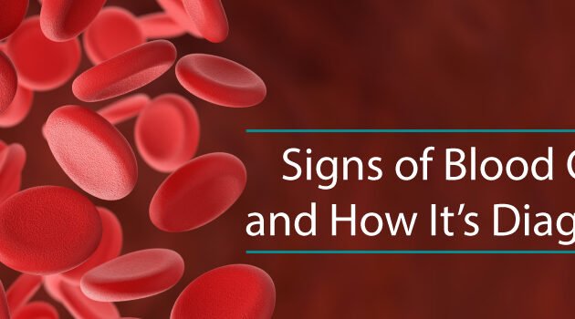 Signs of Blood Cancer and How It’s Diagnosed