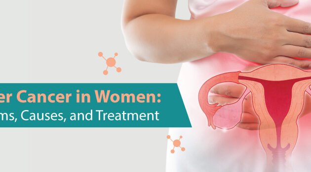 Bladder Cancer in Women