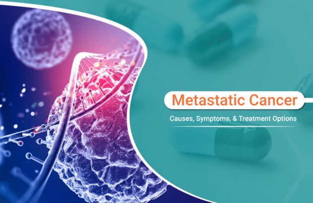 Metastatic Cancer Causes, Symptoms, and Treatment Options