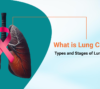 What is Lung Cancer Types and Stages of Lung Cancer