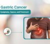 Gastric Cancer Symptoms, Causes, and Treatment